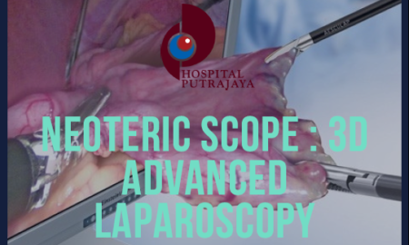Neoteric Scope: 3D Advanced Laparoscopy